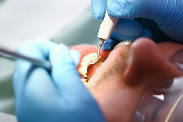 Best Cracked Tooth Emergency Dentist  in Hebron, KY